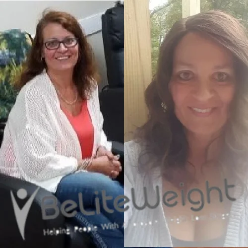 Weight Loss Surgery Before And After Renee J - 4 Year Update*